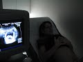 la eco del bebe!