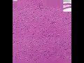 Shotgun Histology Aorta Shotgun Histology Aorta