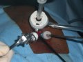 Exicion OfTthe GastrointestinaI Stromal Tumor Of The Proximal Stomach Using A Single Port Access Surgery Exicion OfTthe GastrointestinaI Stromal Tumor Of The Proximal Stomach Using A Single Port Access Surgery