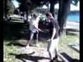 Golf Blooper bloody!!!!!!
