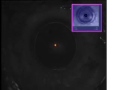 Lasik with Intralase