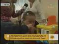 Down syndrome:&nbsp;S�ndrome de Down: Atenci�n temprana