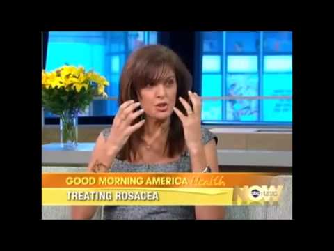 how to treat erythema