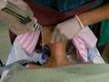 Orotracheal trachlight intubation in a lady with 1.5-2 cm mouth opening