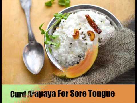 how to cure tongue sores