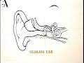 To Hear -- Genetic Deafness Deafness & Hearing Loss