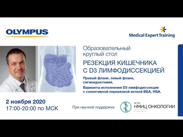 Видеозапись вебинара «Резекция кишечника с лимфодиссекцией D3″