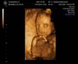 Our baby girl