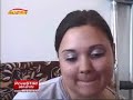 young amputee girl