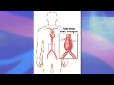 how to repair abdominal aortic aneurysm