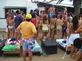 z la manga baile del lumbago pliego