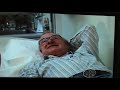 Macular Degeneration and Bone Marrow Stem Cell Therapy