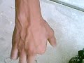 The Worm