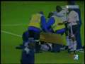 football-accident