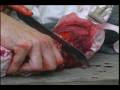 Arm Amputation! Civil War Hospital Reenactment - DVD
