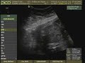 Akimi 6 meses de gesta��o