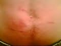 ouch3 ouch3