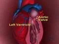 Tiny Hearts Get Fixed In Womb (CBS News)