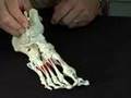 Foot Pain relief