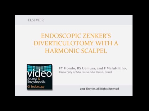how to treat zenker's diverticulum