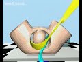 Birth simulator robot helps trainees get a grip