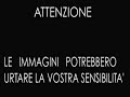 Asilo Pistoia : il video dei maltrattamenti