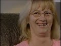 7 Years Later, Pit Bull Attack Victim Speaks