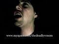 mozez flowz- rigamortis mozez flowz- rigamortis