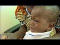 The Pulse-The disease defeating scientists -03Dec07-Ep6-Pt 2