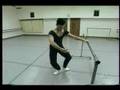 Hip Resurfacing: Study, 1999