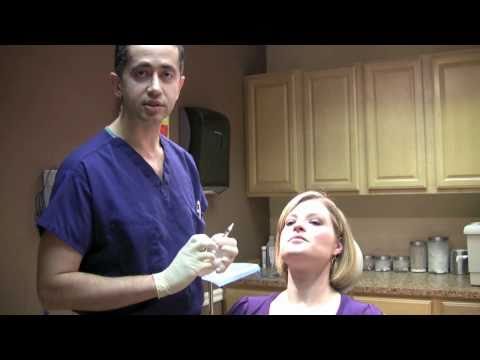 how to eliminate vertical lip lines