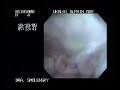 endoscopia ukalai endoscopia ukalai