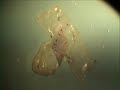 Injerto de Aneurisma Sacular en Aorta de Rata Wistar