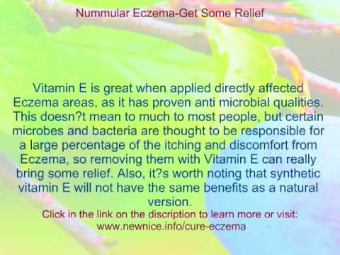 how to cure nummular eczema