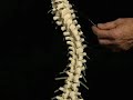 Erik Dalton Scoliosis and Back Pain
