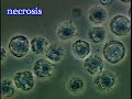 科学映像館  MEDICAL　Necrosis　ネクローシス