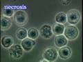 科学映像館 MEDICAL Necrosis ネクローシス