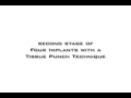 Comprehensive Implant Dentistry Live Training Courses at MiamiImplantsLive.com