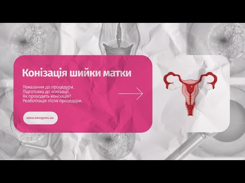 Конизация шейки матки