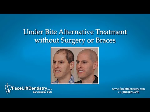 how to fix underbite