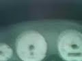 MG ZS TD repro