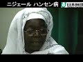 ????? ???????????/ Leprosy Elimination in Niger ????? ???????????/ Leprosy Elimination in Niger