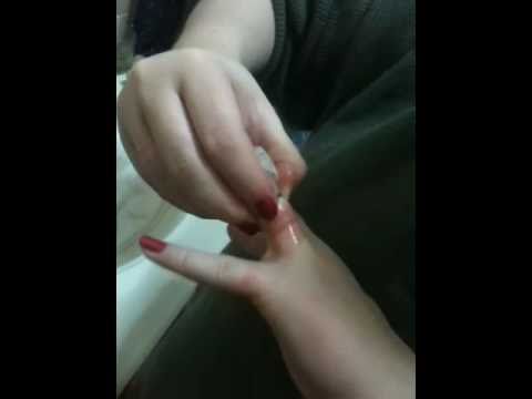 how to get a ring off a swollen finger