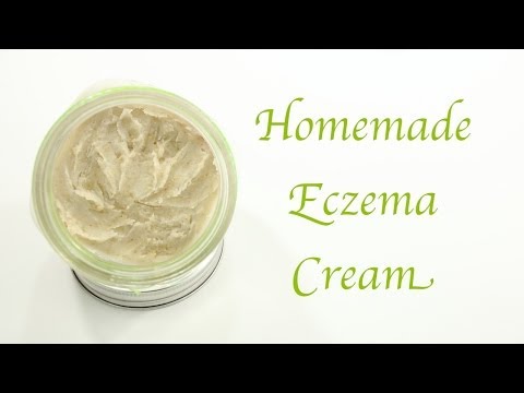 how to make eczema cream