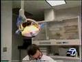 Periolase - Laser Gum Treatment