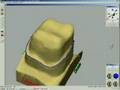Cerec 3D - Sirona Training Video. Parte 2 di 2.