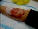 The Kuchma Experiment #2 - Leg Burning