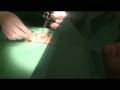 videos de Surgery part 1/2