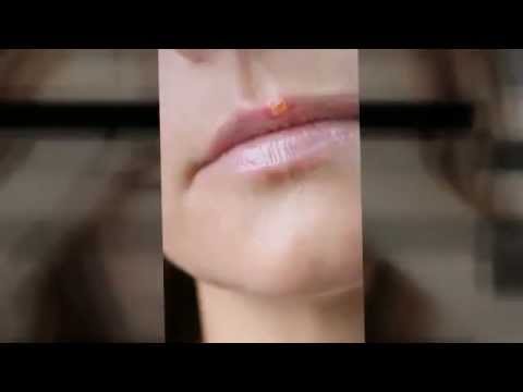 how to get rid of a cold with vitamin c