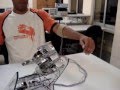 Myoelectric Hand Prosthesis: Black Widow finalist